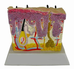 Psoriasis Skin Model Pharmaceutical and Anatomical Model Gifts